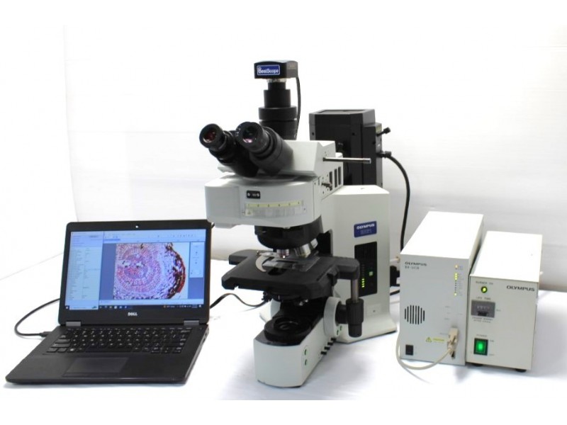 Olympus BX61 Upright Fluorescence Motorized Microscope (New Filters)