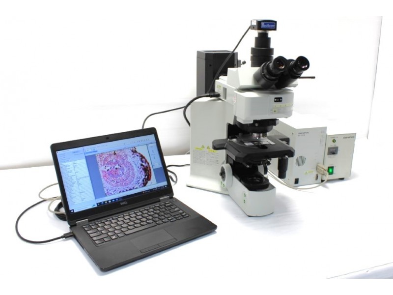 Olympus BX61 Upright Fluorescence Motorized Microscope (New Filters)