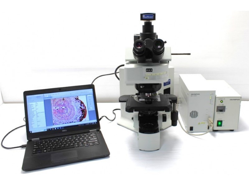 Olympus BX61 Upright Fluorescence Motorized Microscope (New Filters)