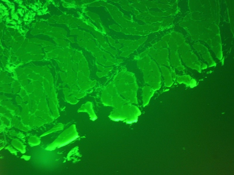 Zeiss Axioplan 2 Upright Metal Halide Fluorescence Microscope (New Filters) Pred Axioscope 5