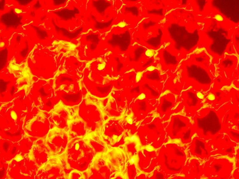 Zeiss Axioskop 2 Upright Fluorescence Microscope (New Filters) Pred Axioscope 5