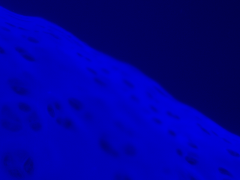 Zeiss Axioskop 2 Upright Fluorescence Microscope (New Filters) Pred Axioscope 5