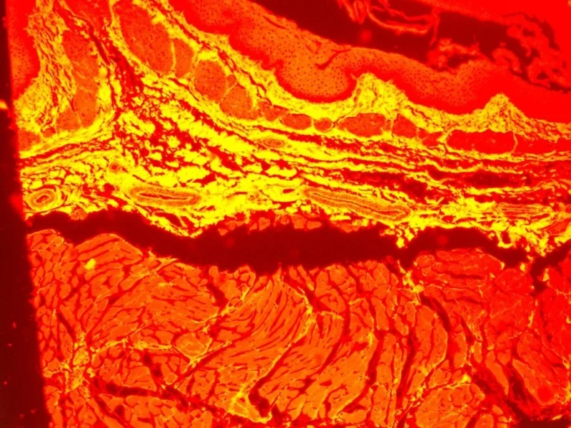 Zeiss Axiovert 200m Inverted Fluorescence Phase Contrast Microscope ...