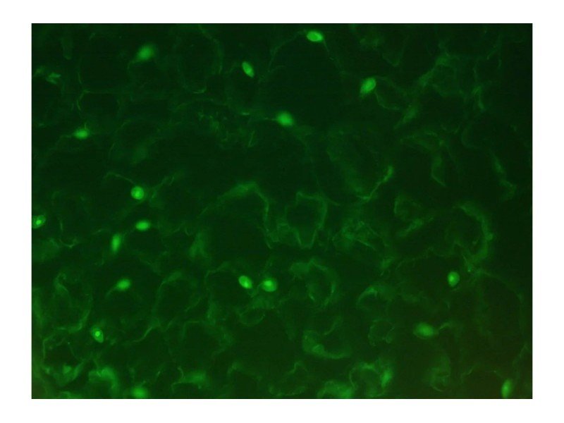 Leica DM6000 Upright Fluorescence Motorized Microscope Leica DM6000 Upright Fluorescence Motorized Microscope