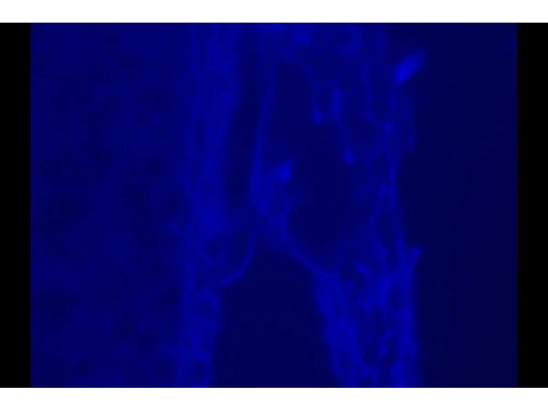 Leica DM6000 Upright Fluorescence Motorized Microscope with Motorized XY Stage Leica DM6000 Upright Fluorescence Motorized Microscope with Motorized XY Stage