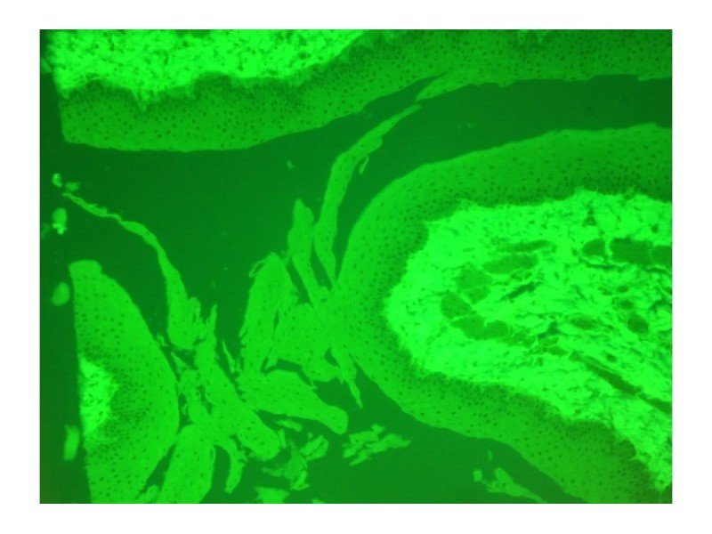 Nikon Eclipse 80i Upright Fluorescence Microscope (New Filters)