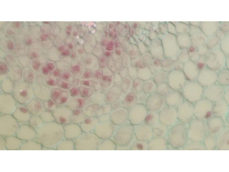 Nikon Eclipse Ti2-E PFS Inverted LED Fluorescence DIC Motorized Microscope (New Filters and Perfect Focus System)