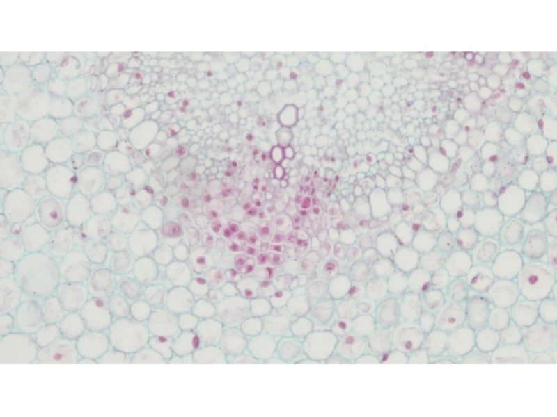 Nikon Eclipse Ti2-E PFS Inverted LED Fluorescence DIC Motorized Microscope (New Filters and Perfect Focus System)