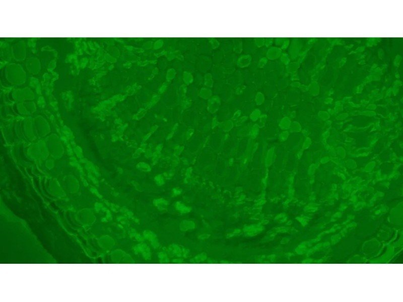 Olympus BX46F Upright Fluorescence Microscope (New Filters) Olympus BX46F Upright Fluorescence Microscope (New Filters)