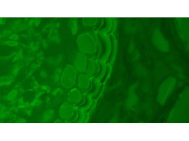 Olympus BX46F Upright Fluorescence Microscope (New Filters) Olympus BX46F Upright Fluorescence Microscope (New Filters)