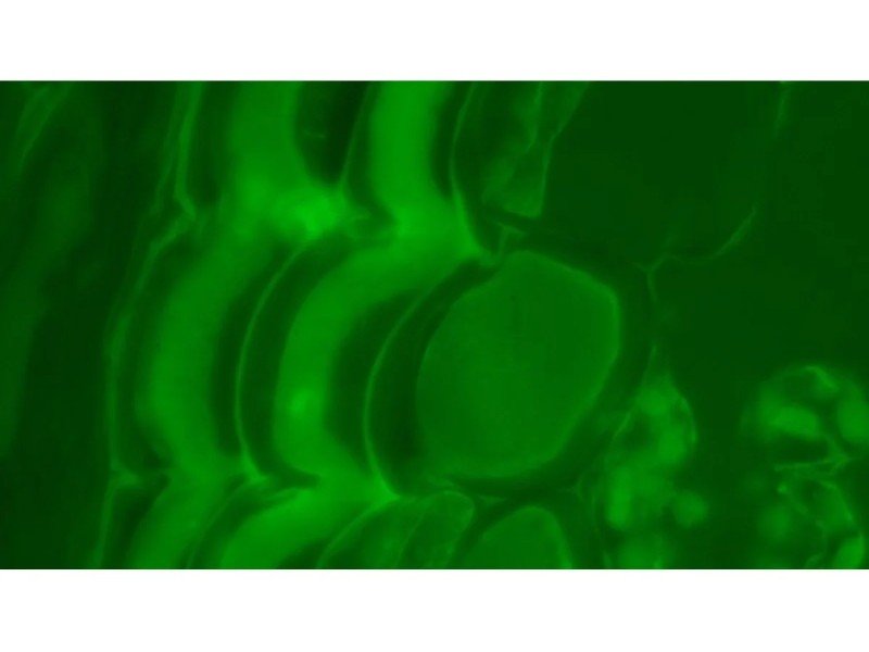 Olympus BX46F Upright Fluorescence Microscope (New Filters) Olympus BX46F Upright Fluorescence Microscope (New Filters)