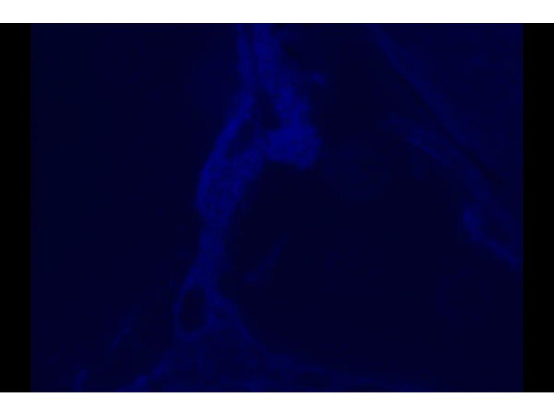 Olympus BX51 Upright Fluorescence Phase Contrast Mechanical Microscope (New Filters)