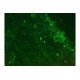 Olympus IX70 Inverted Fluorescence Metal Halide Microscope (New Filters) Olympus IX70 Inverted Fluorescence Metal Halide Microscope (New Filters)