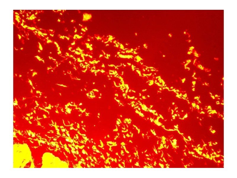 Olympus IX81 Inverted Fluorescence Motorized Microscope (New Filters)