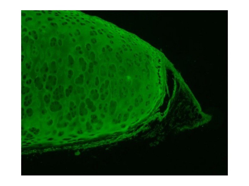 Olympus IX81 Inverted Fluorescence Motorized XY Microscope (New Filters)