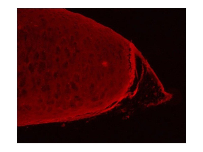 Olympus IX81 Inverted Fluorescence Motorized XY Microscope (New Filters)