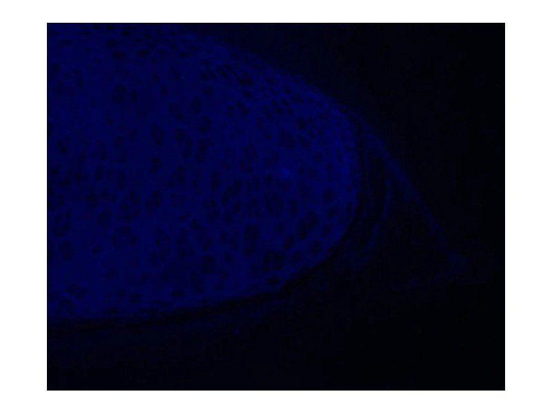 Olympus IX81 Inverted Fluorescence Motorized XY Microscope (New Filters)