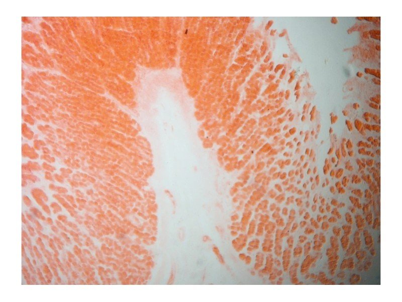 Zeiss AXIO Imager M1 Upright Fluorescence Motorized XYZ Microscope (New Filters)