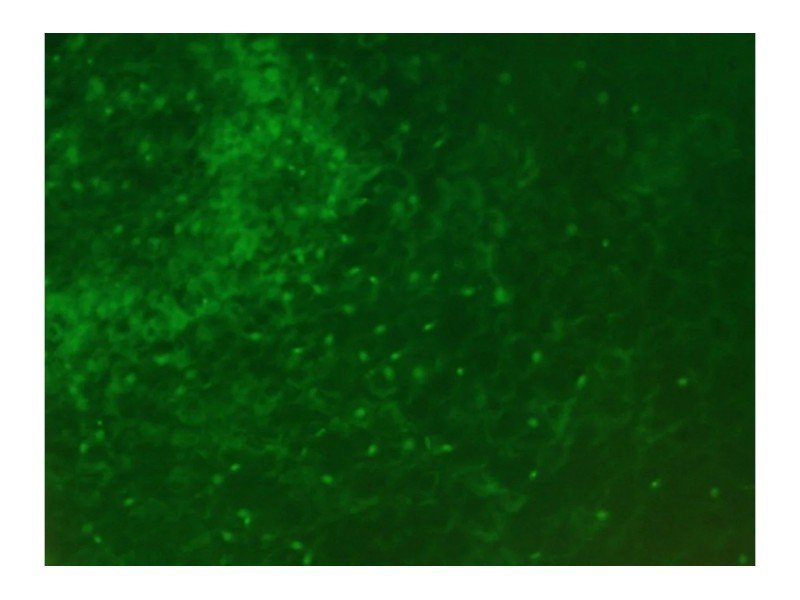 Zeiss Axiovert 200m Inverted Fluorescence Microscope Motorized XY (New Filters)