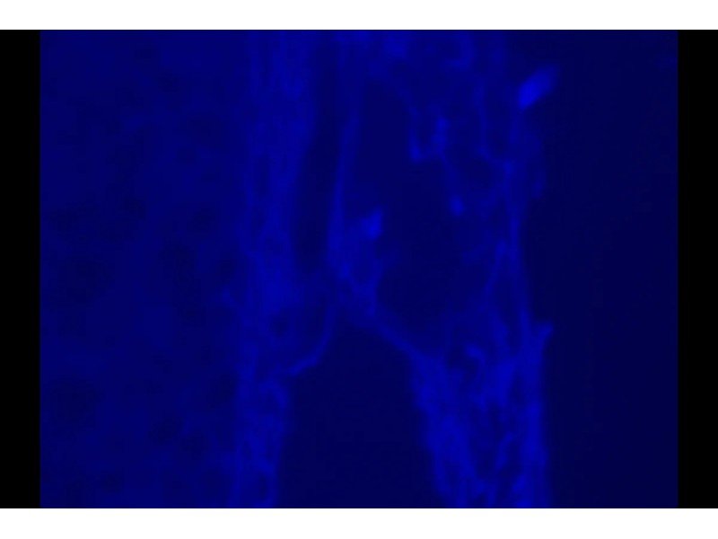 Zeiss AXIO Observer Z1 Inverted Fluorescence Motorized XY Microscope Zeiss AXIO Observer Z1 Inverted Fluorescence Motorized XY Microscope