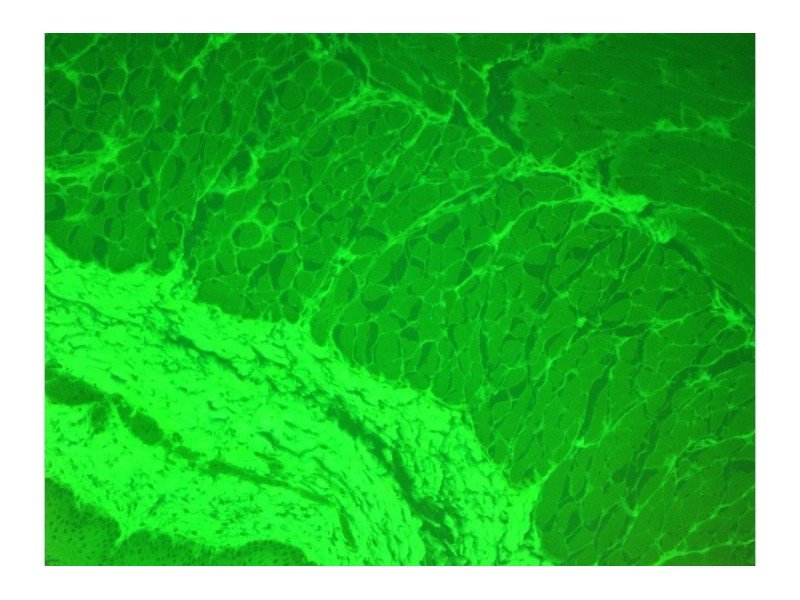 Zeiss AXIO Observer Z1 Inverted Fluorescence Motorized XY Microscope Zeiss AXIO Observer Z1 Inverted Fluorescence Motorized XY Microscope