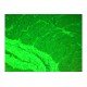 Zeiss AXIO Observer Z1 Inverted Fluorescence Motorized XY Microscope Zeiss AXIO Observer Z1 Inverted Fluorescence Motorized XY Microscope