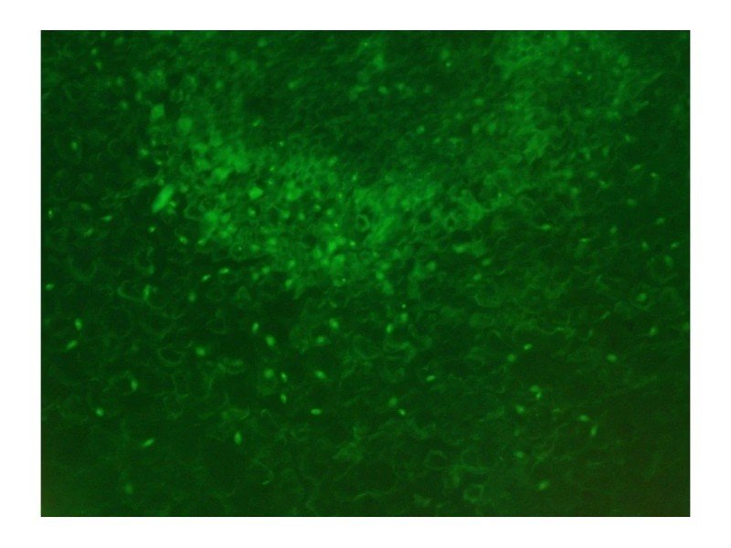 Nikon Eclipse TE2000-U Inverted Fluorescence Microscope