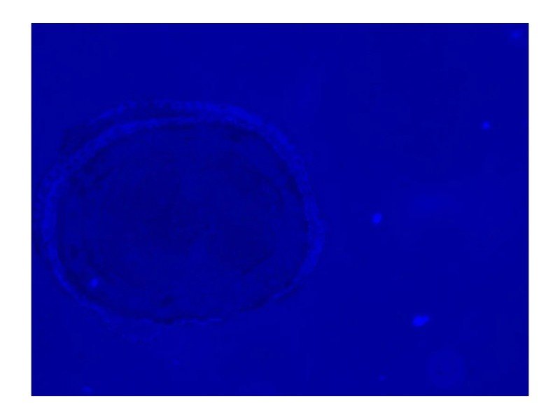 Thermo Invitrogen EVOS M5000 Phase Contrast Fluorescence Microscope Imaging System Unit 2 Thermo Invitrogen EVOS M5000 Phase Contrast Fluorescence Microscope Imaging System Unit 2