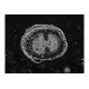Thermo Invitrogen EVOS M5000 Phase Contrast Fluorescence Microscope Imaging System Unit 2 Thermo Invitrogen EVOS M5000 Phase Contrast Fluorescence Microscope Imaging System Unit 2