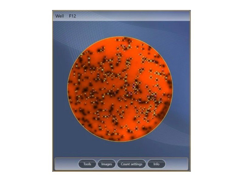AID iSpot Spectrum ELR088IFL Elispot Microplate Reader AID iSpot Spectrum ELR088IFL Elispot Microplate Reader