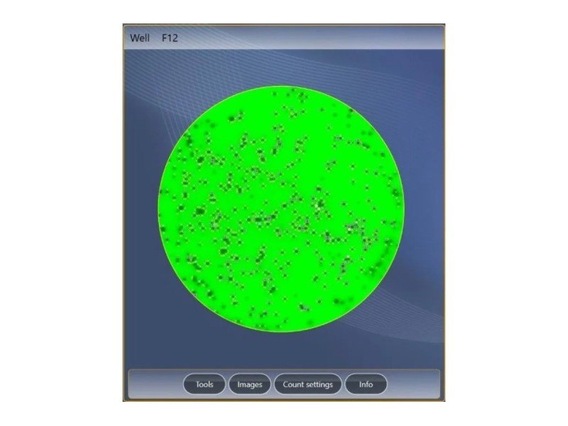 AID iSpot Spectrum ELR088IFL Elispot Microplate Reader AID iSpot Spectrum ELR088IFL Elispot Microplate Reader