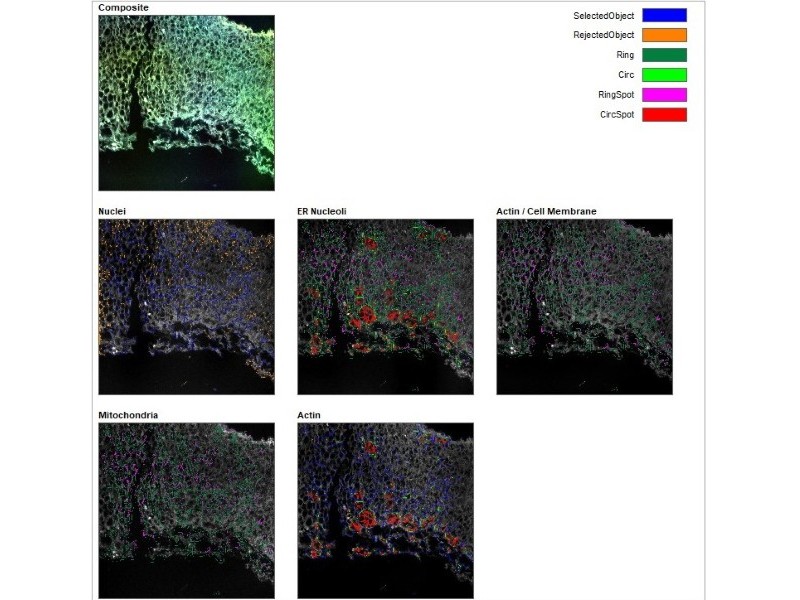 Thermo CellInsight CX7 LZR Pro High Content Confocal Analysis Platform