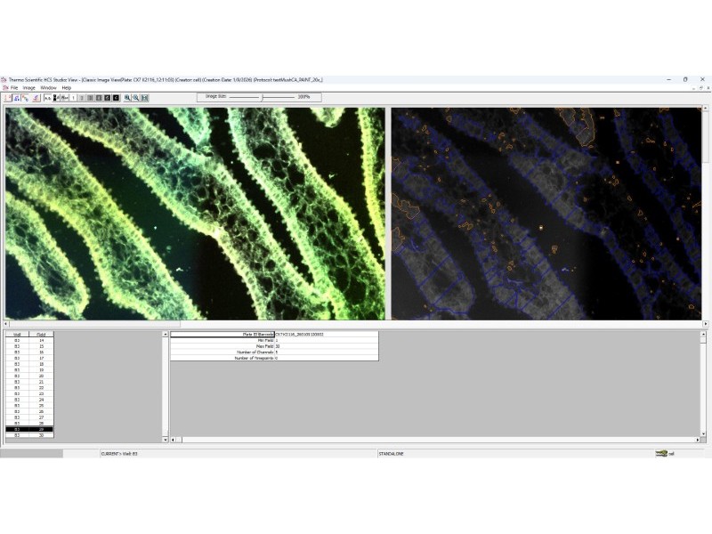 Thermo CellInsight CX7 LZR Pro High Content Confocal Analysis Platform