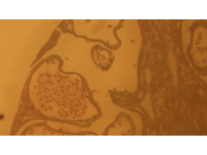Zeiss AXIO Imager.Z1 Motorized DIC Metallurgical and Materials Microscope
